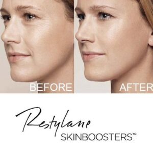 Skinbooster Faceup