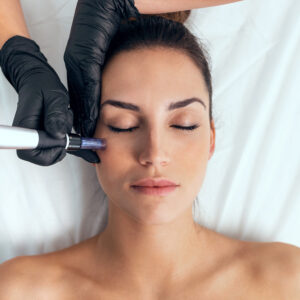 Dermapen Hidratante Anti-aging en Polanco