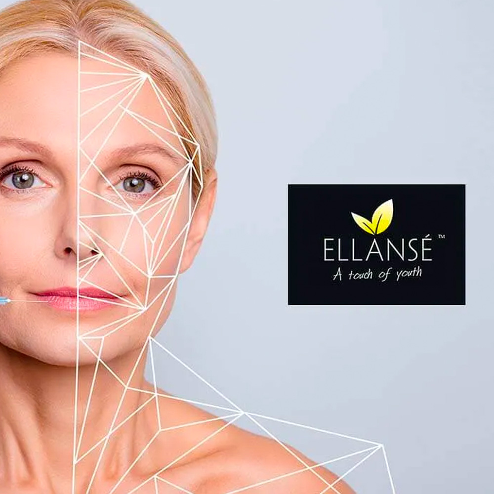 Ellanse FACEUP Bioestimulador Facial